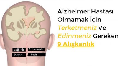 Alzheimer Hastası Olmamak İçin Terketmeniz Ve Edinmeniz Gereken 9 Alışkanlık